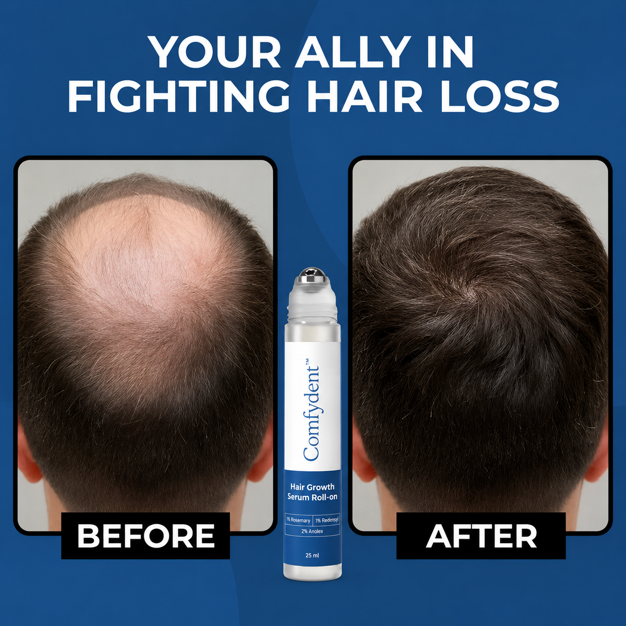 Comfydent before and after hair growth results